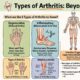 Types of Arthritis